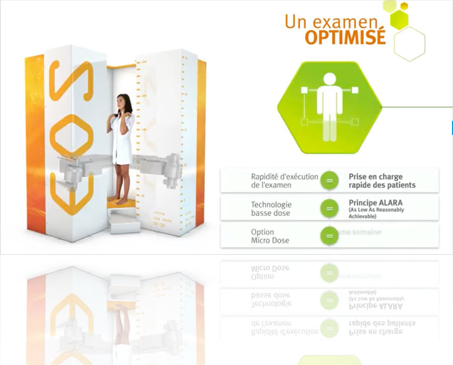 EOS Imaging, Design Axena